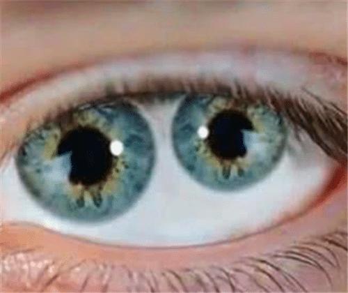 古代拥有“双重瞳孔”的人有哪些？他们眼中的世界与常人有何不同